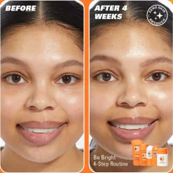 Revolution Skin Be Bright 4 Step Starter Kit Minis