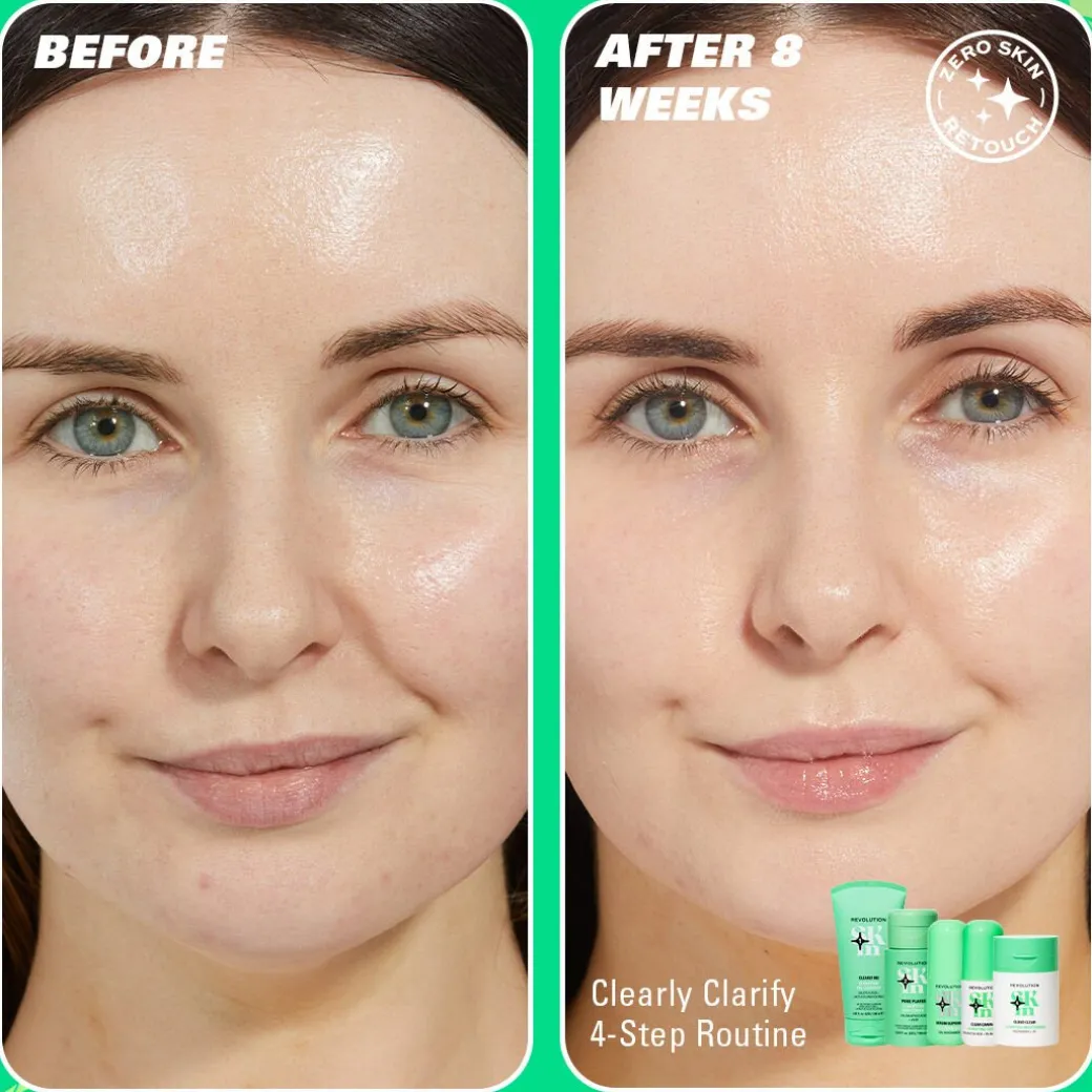 Revolution Skin Clearly Clarify 4 Step Starter Kit Minis