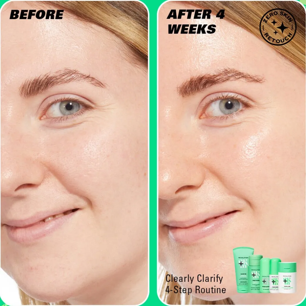 Revolution Skin Clearly Clarify 4 Step Starter Kit Minis
