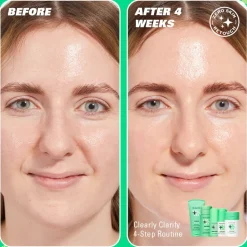 Revolution Skin Cloud Clear Clarifying Moisturizer 50ml